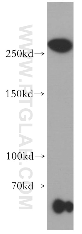 Western Blot (WB) analysis of human brain tissue using SETD1B Polyclonal antibody (55005-1-AP)