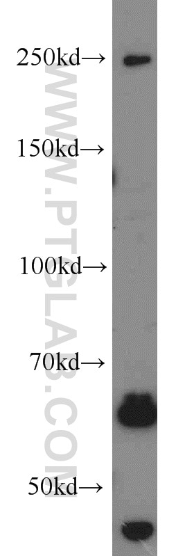 Western Blot (WB) analysis of mouse liver tissue using SETD1B Polyclonal antibody (55005-1-AP)