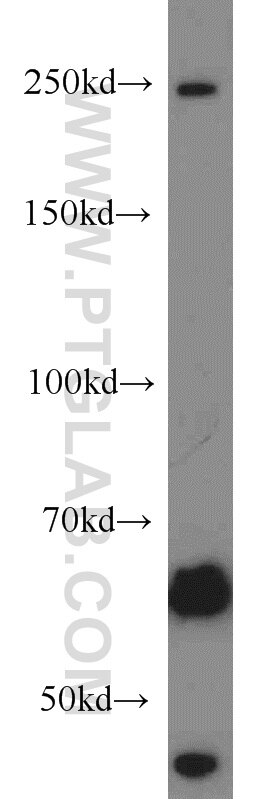 Western Blot (WB) analysis of mouse liver tissue using SETD1B Polyclonal antibody (55005-1-AP)