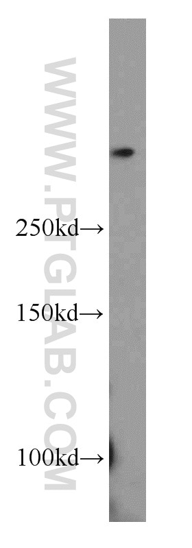 Western Blot (WB) analysis of MCF-7 cells using SETD1B Polyclonal antibody (55005-1-AP)