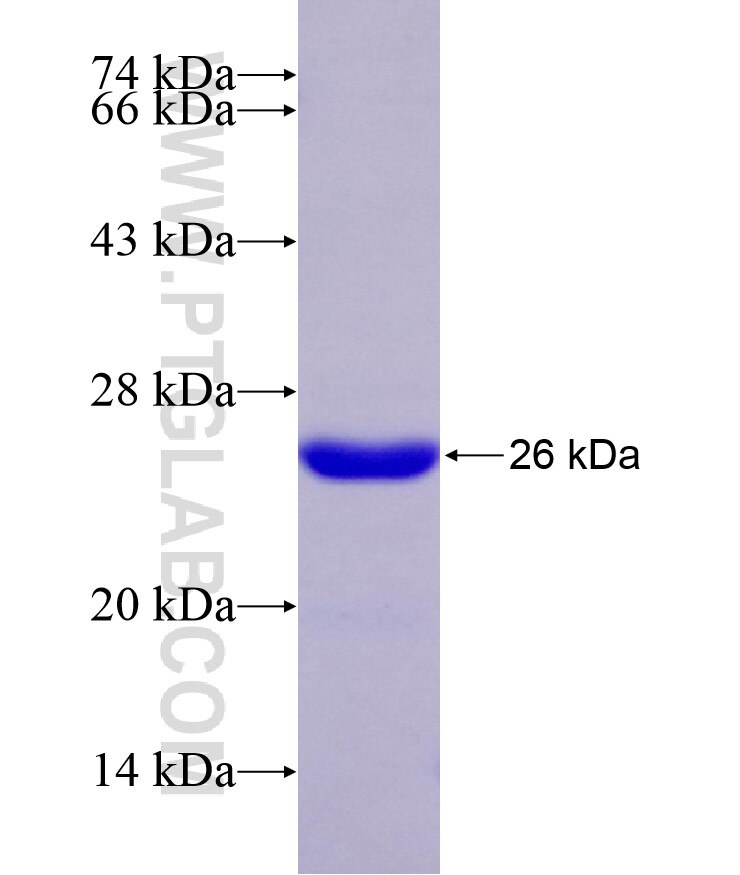 SETD1B fusion protein Ag29127 SDS-PAGE