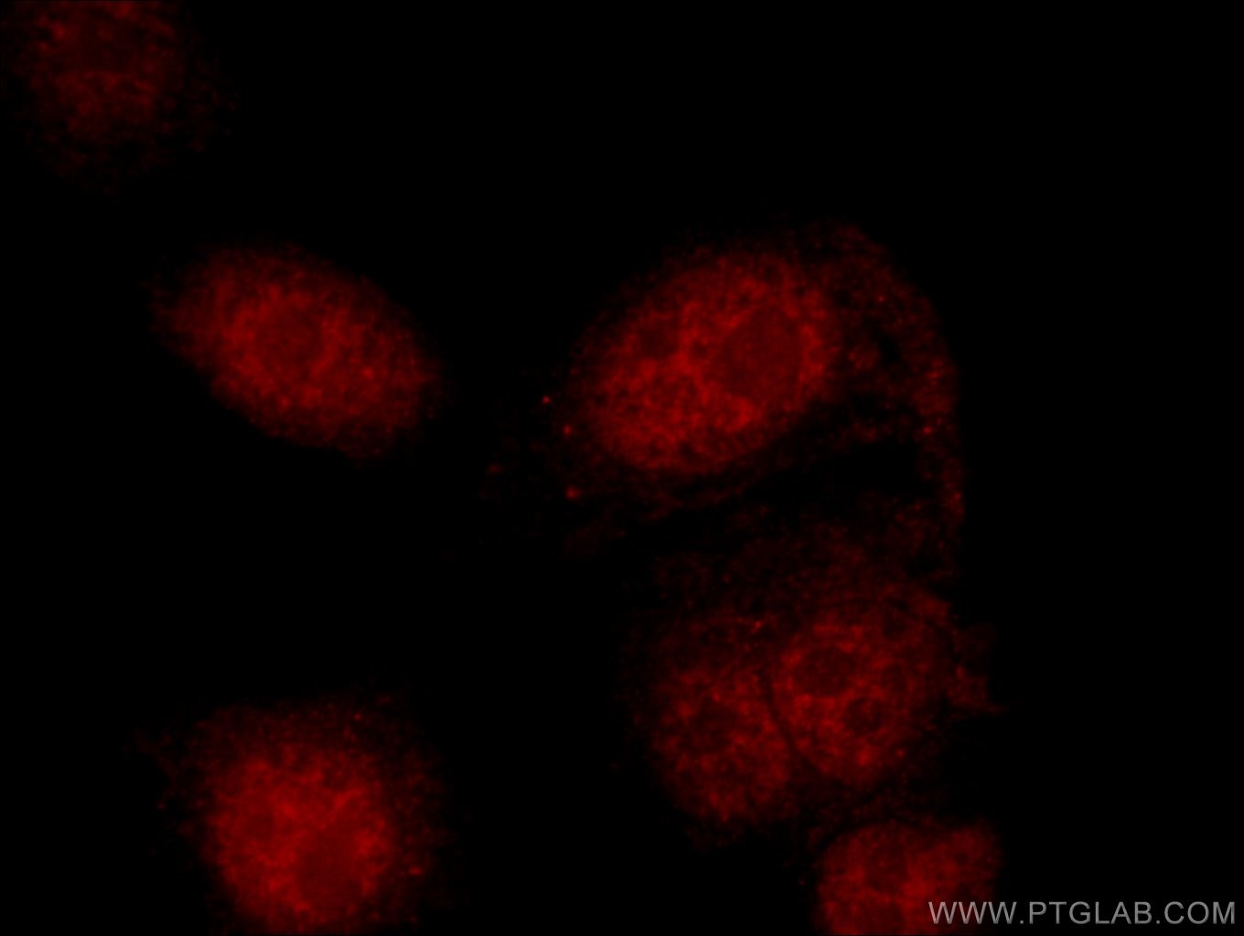 Immunofluorescence (IF) / fluorescent staining of HepG2 cells using SETD2 Polyclonal antibody (55377-1-AP)