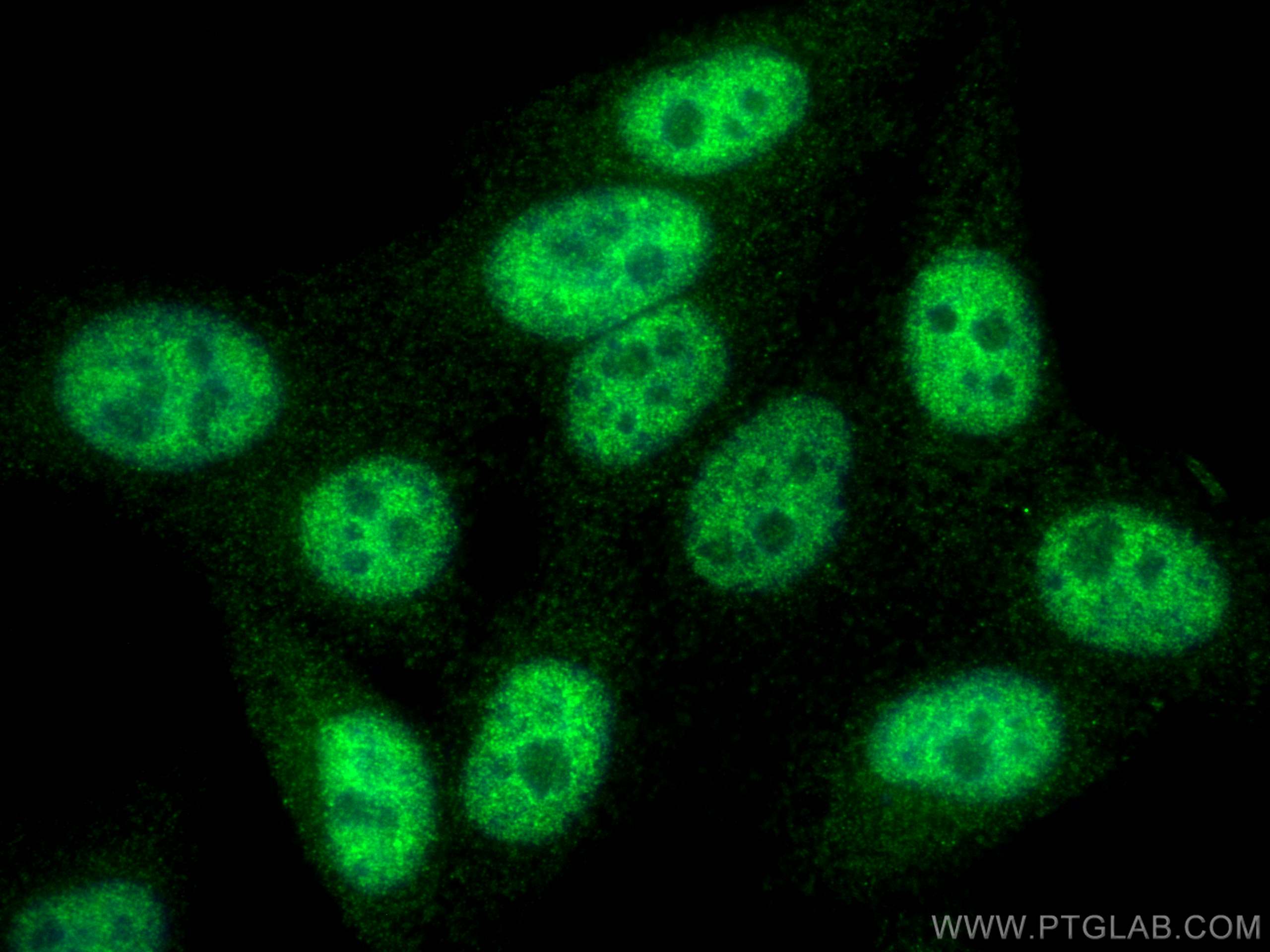 Immunofluorescence (IF) / fluorescent staining of HepG2 cells using SETD2 Polyclonal antibody (55377-1-AP)