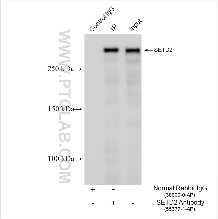 Immunoprecipitation (IP) experiment of Jurkat cells using SETD2 Polyclonal antibody (55377-1-AP)