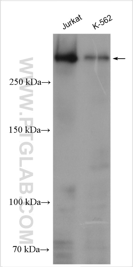 Western Blot (WB) analysis of various lysates using SETD2 Polyclonal antibody (55377-1-AP)