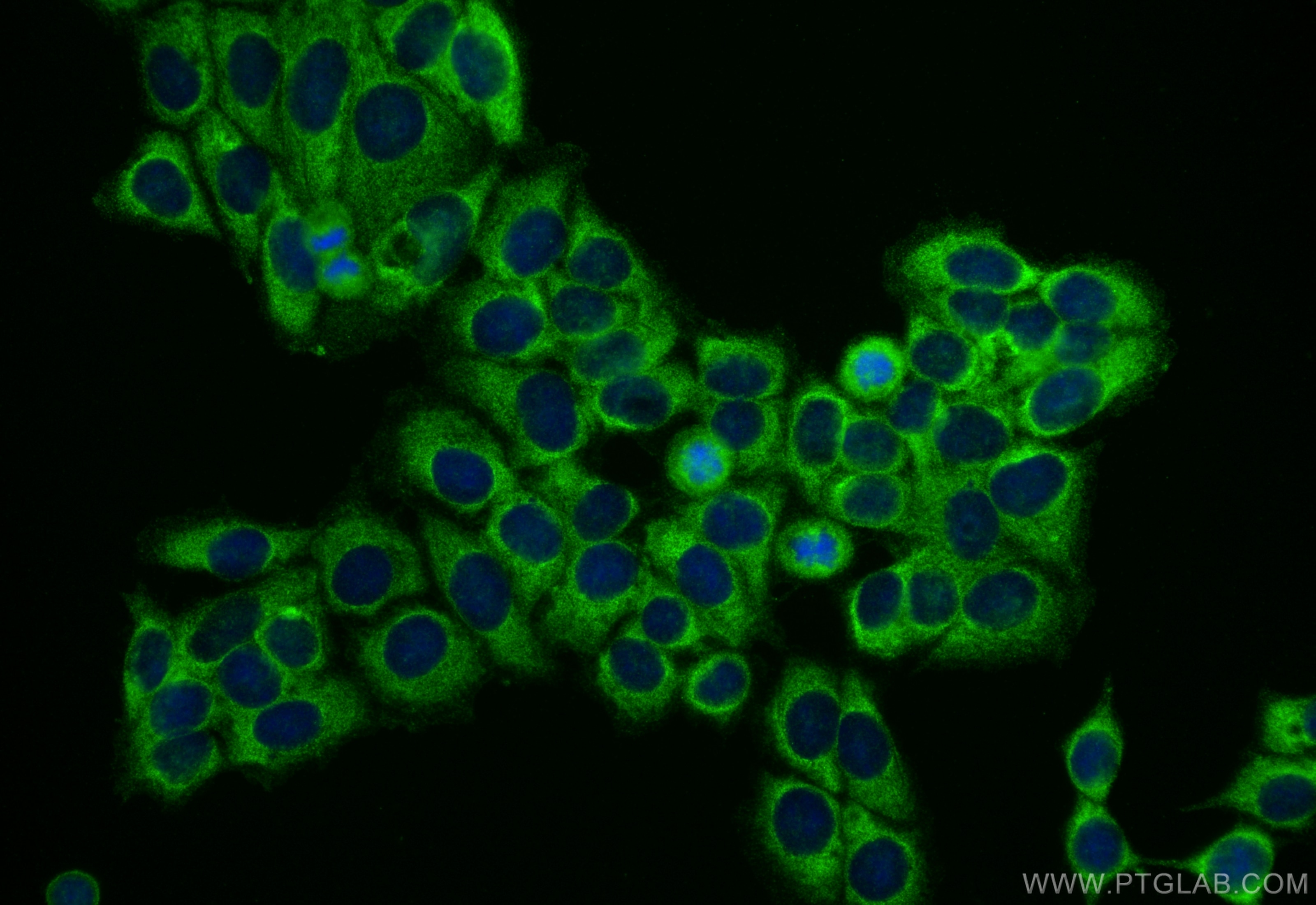Immunofluorescence (IF) / fluorescent staining of MCF-7 cells using SETD3 Polyclonal antibody (28692-1-AP)