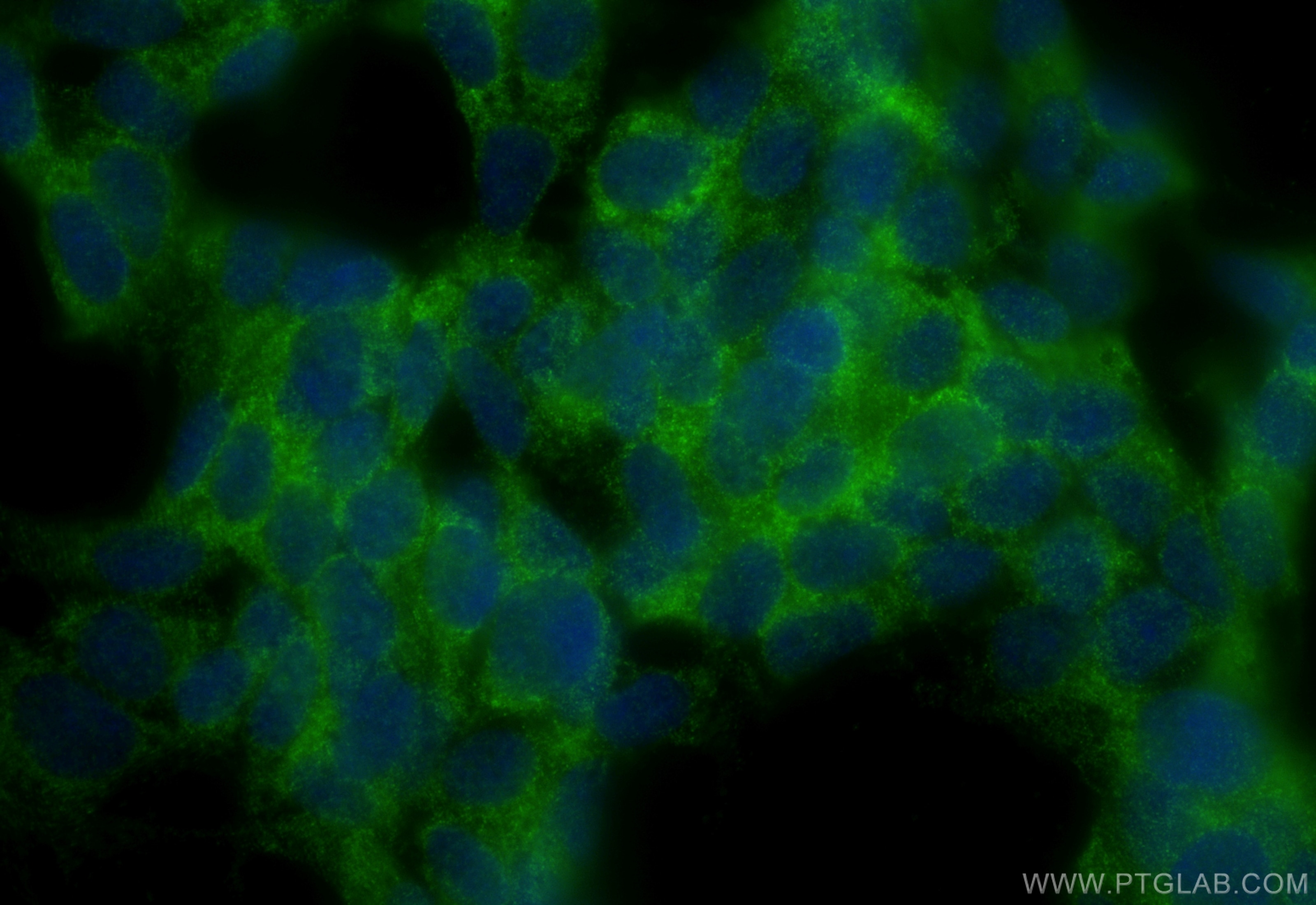 Immunofluorescence (IF) / fluorescent staining of SH-SY5Y cells using SETD3 Polyclonal antibody (28692-1-AP)