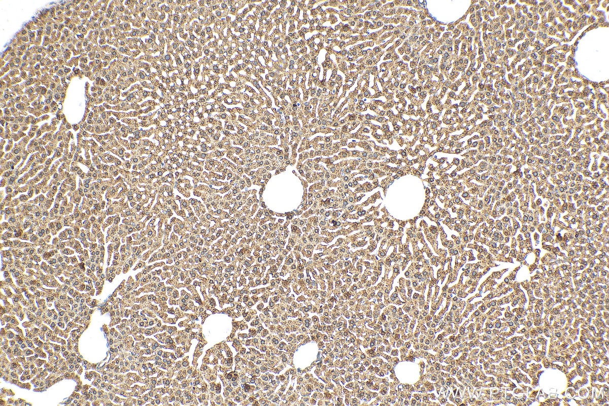 Immunohistochemistry (IHC) staining of mouse liver tissue using SETD3 Polyclonal antibody (28692-1-AP)
