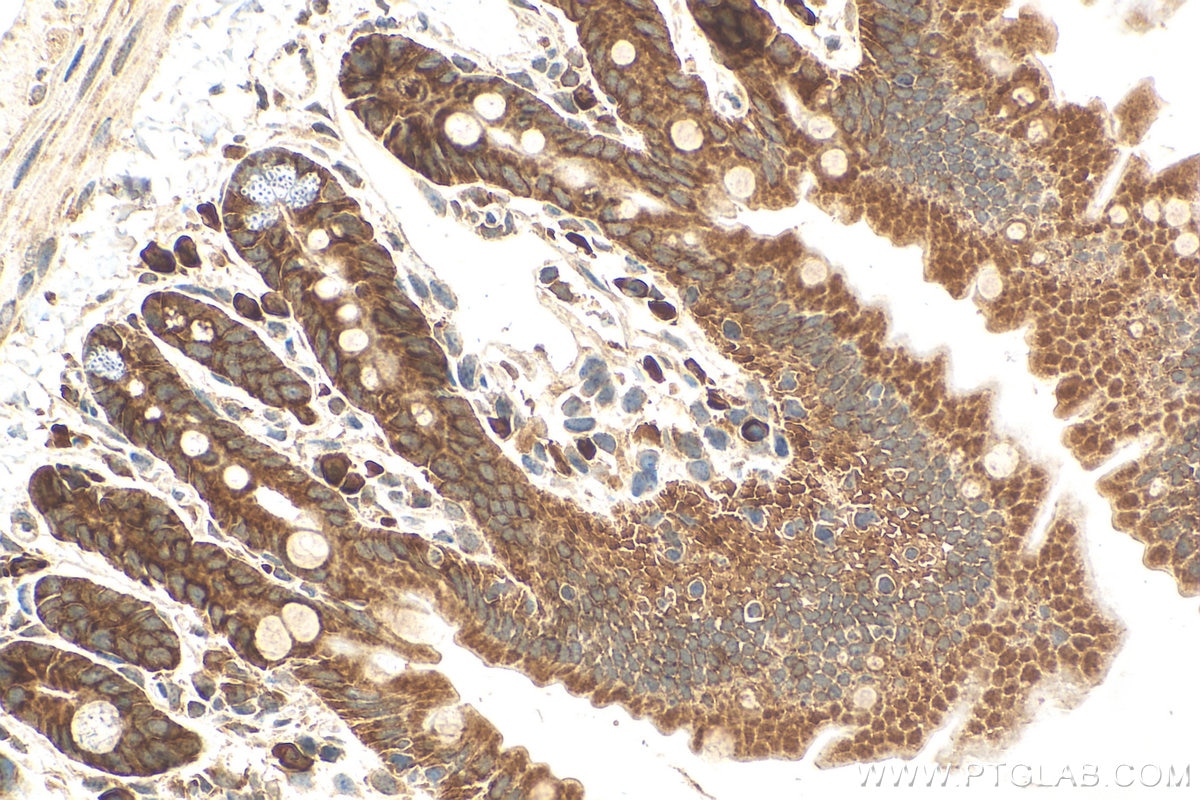 Immunohistochemistry (IHC) staining of mouse small intestine tissue using SETD3 Polyclonal antibody (28692-1-AP)