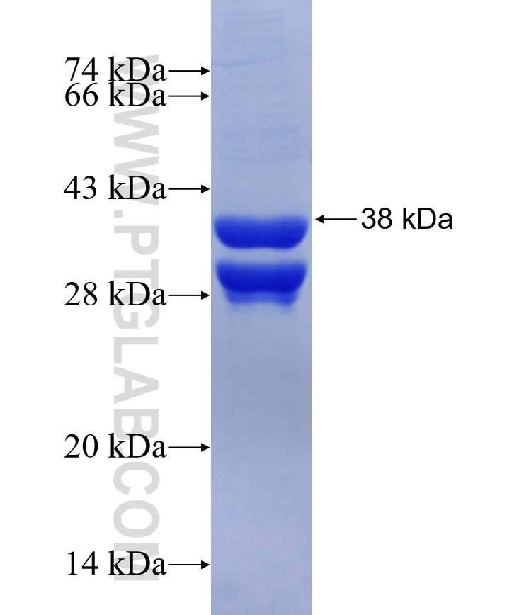 SETD3 fusion protein Ag30017 SDS-PAGE
