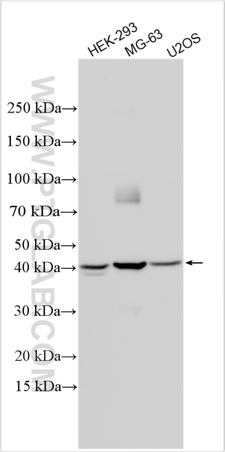 Western Blot (WB) analysis of various lysates using SETD4 Polyclonal antibody (30855-1-AP)