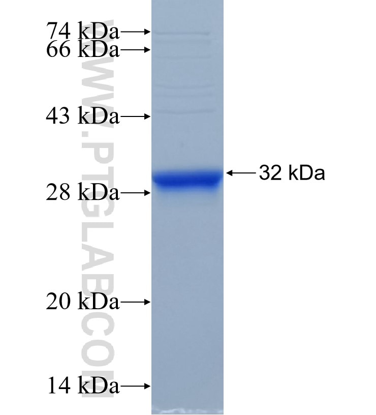 SETD4 fusion protein Ag33842 SDS-PAGE