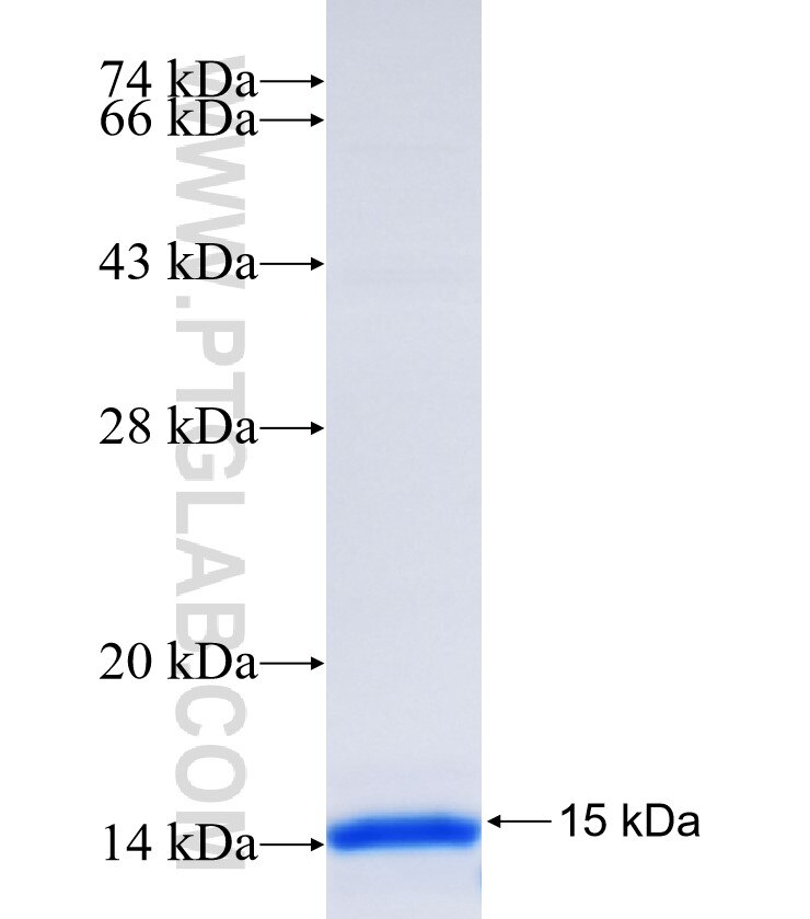 SETD4 fusion protein Ag33883 SDS-PAGE SETD4 fusion protein Ag33883 SDS-PAGE