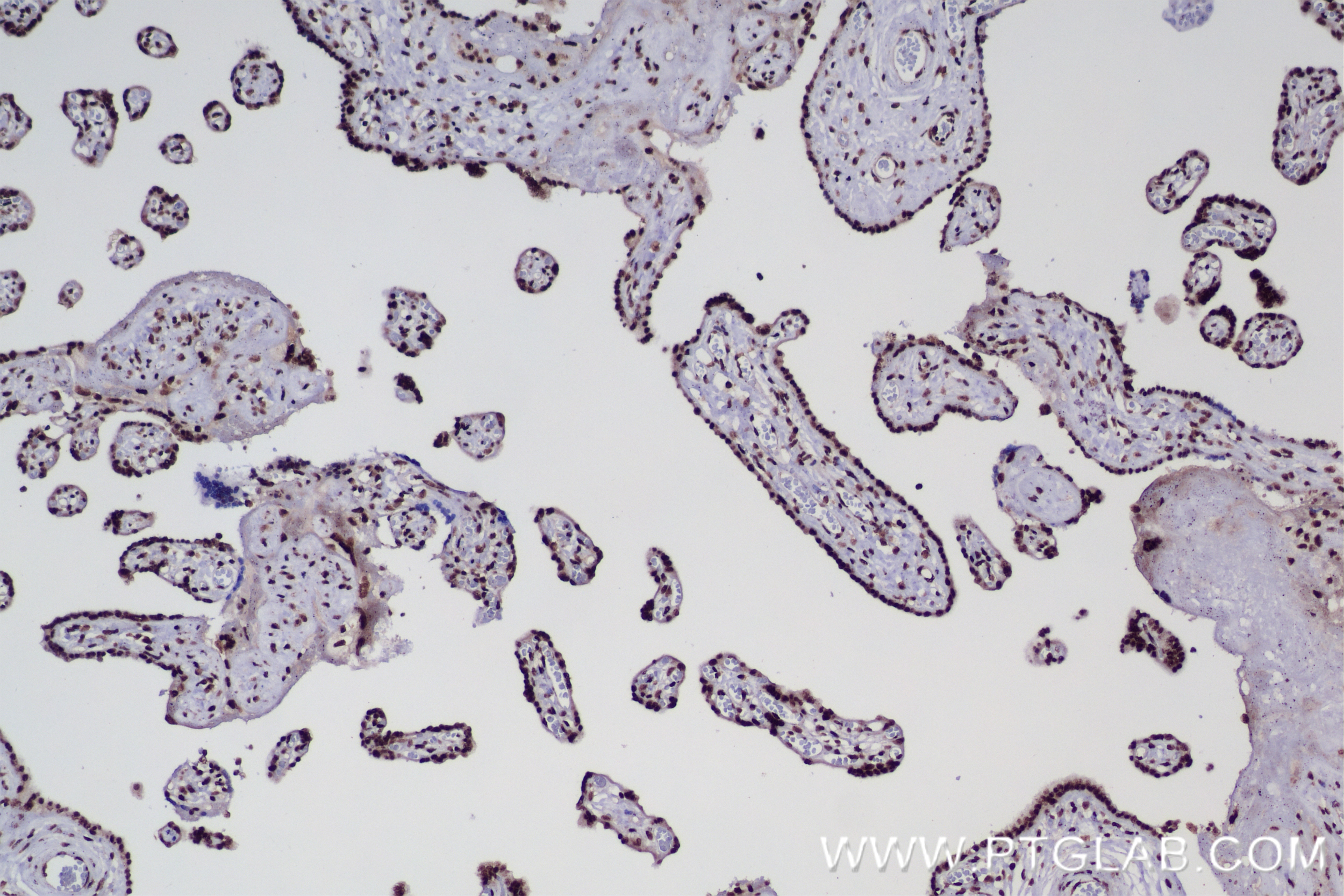 Immunohistochemistry (IHC) staining of human placenta tissue using SETD5 Recombinant antibody (84622-1-RR)