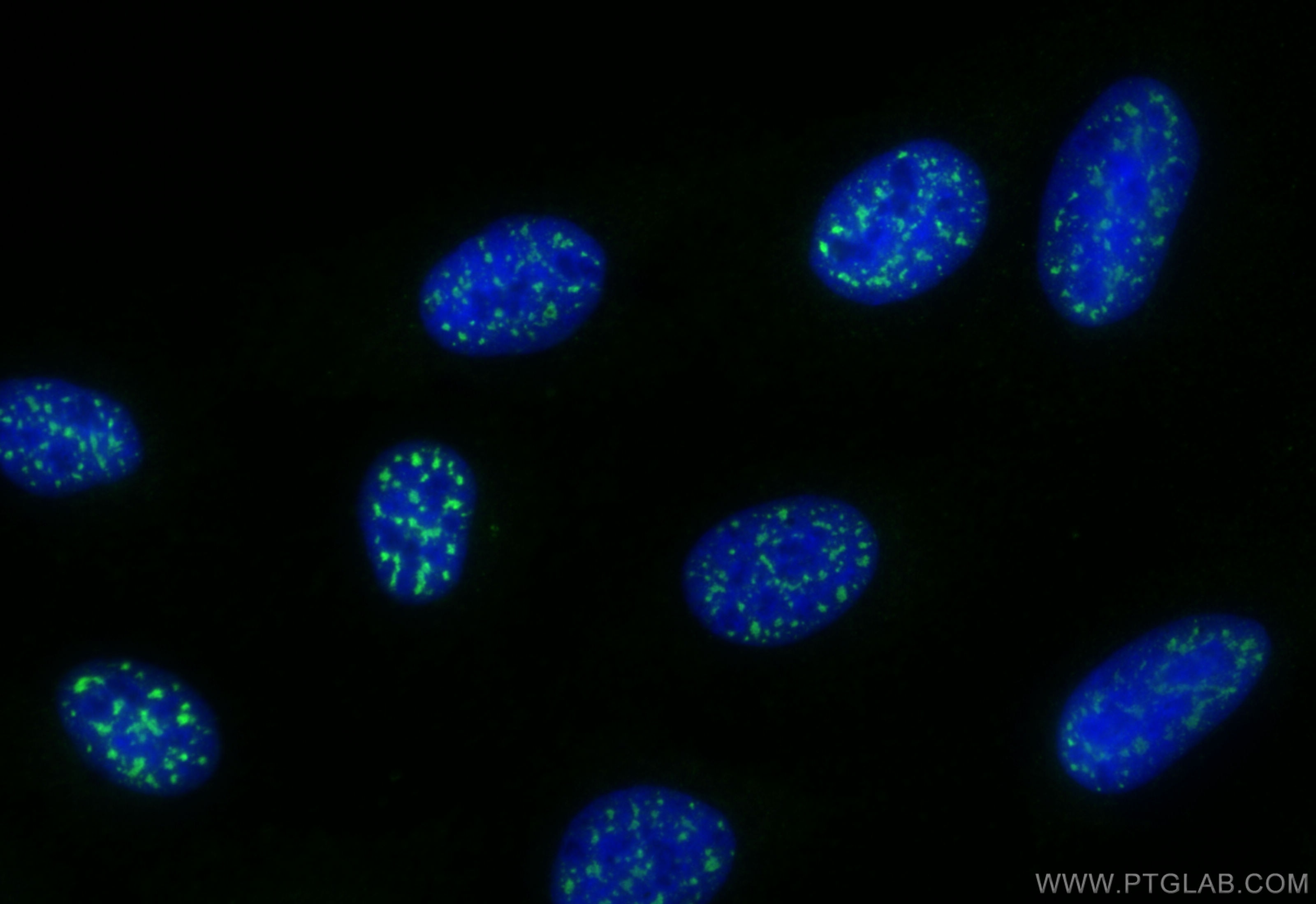 Immunofluorescent analysis of (4% PFA) fixed U2OS cells using CoraLite® Plus 488 SETD5 antibody (CL488-84622, Clone: 241903A3 ) at dilution of 1:200. Immunofluorescence (IF) / fluorescent staining of U2OS cells using CoraLite® Plus 488-conjugated SETD5 Recombinant an (CL488-84622)