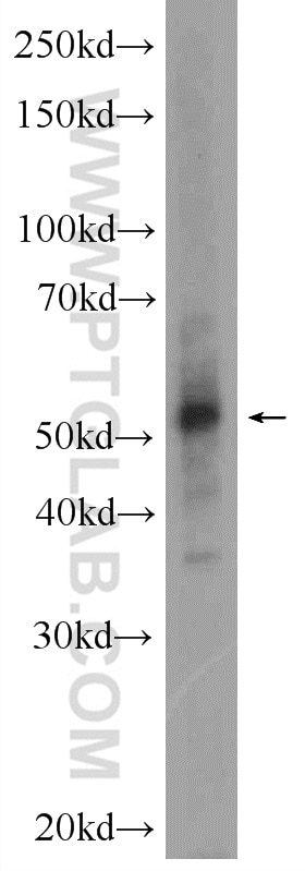 Western Blot (WB) analysis of RAW 264.7 cells using SETD6 Polyclonal antibody (24377-1-AP)
