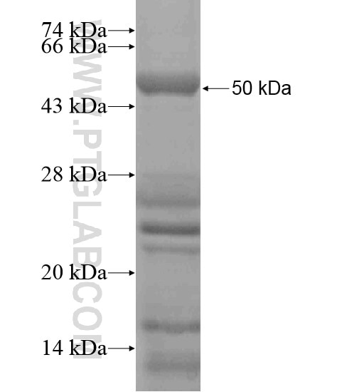 SETD6 fusion protein Ag19485 SDS-PAGE