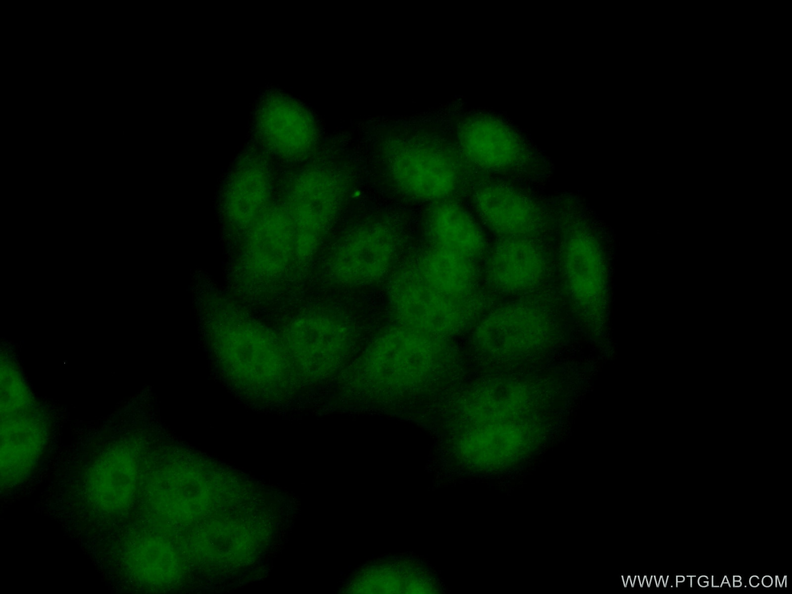 Immunofluorescence (IF) / fluorescent staining of HeLa cells using SETD7 Polyclonal antibody (24840-1-AP)