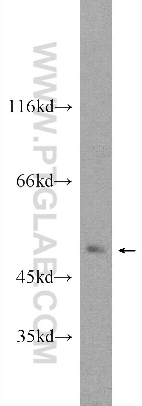 Western Blot (WB) analysis of C6 cells using SETD7 Polyclonal antibody (24840-1-AP)