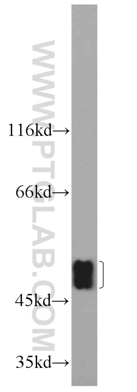 Western Blot (WB) analysis of mouse brain tissue using SETD7 Polyclonal antibody (24840-1-AP)