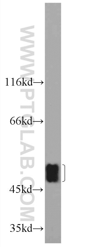 WB analysis of mouse brain using 24840-1-AP