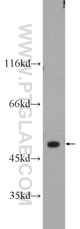 Western Blot (WB) analysis of mouse kidney tissue using SETD7 Polyclonal antibody (24840-1-AP)