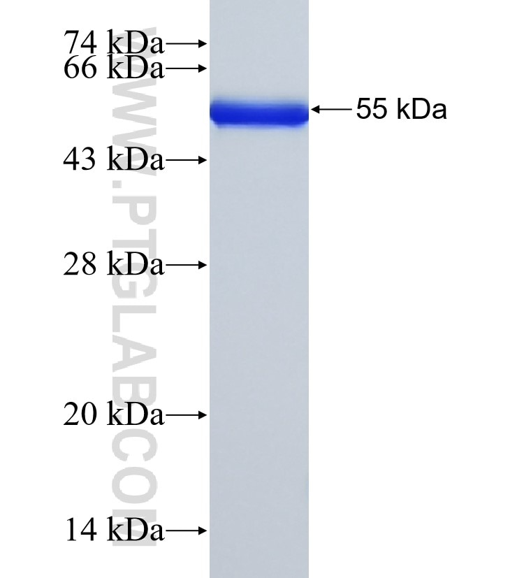 SETD7 fusion protein Ag33803 SDS-PAGE
