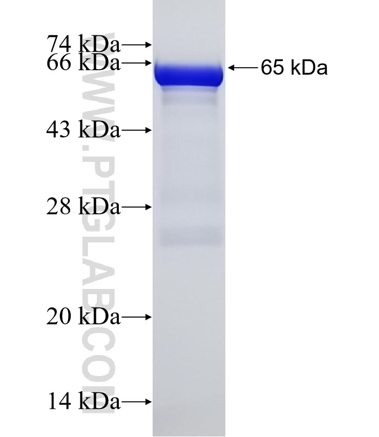 SETD8 fusion protein Ag5114 SDS-PAGE