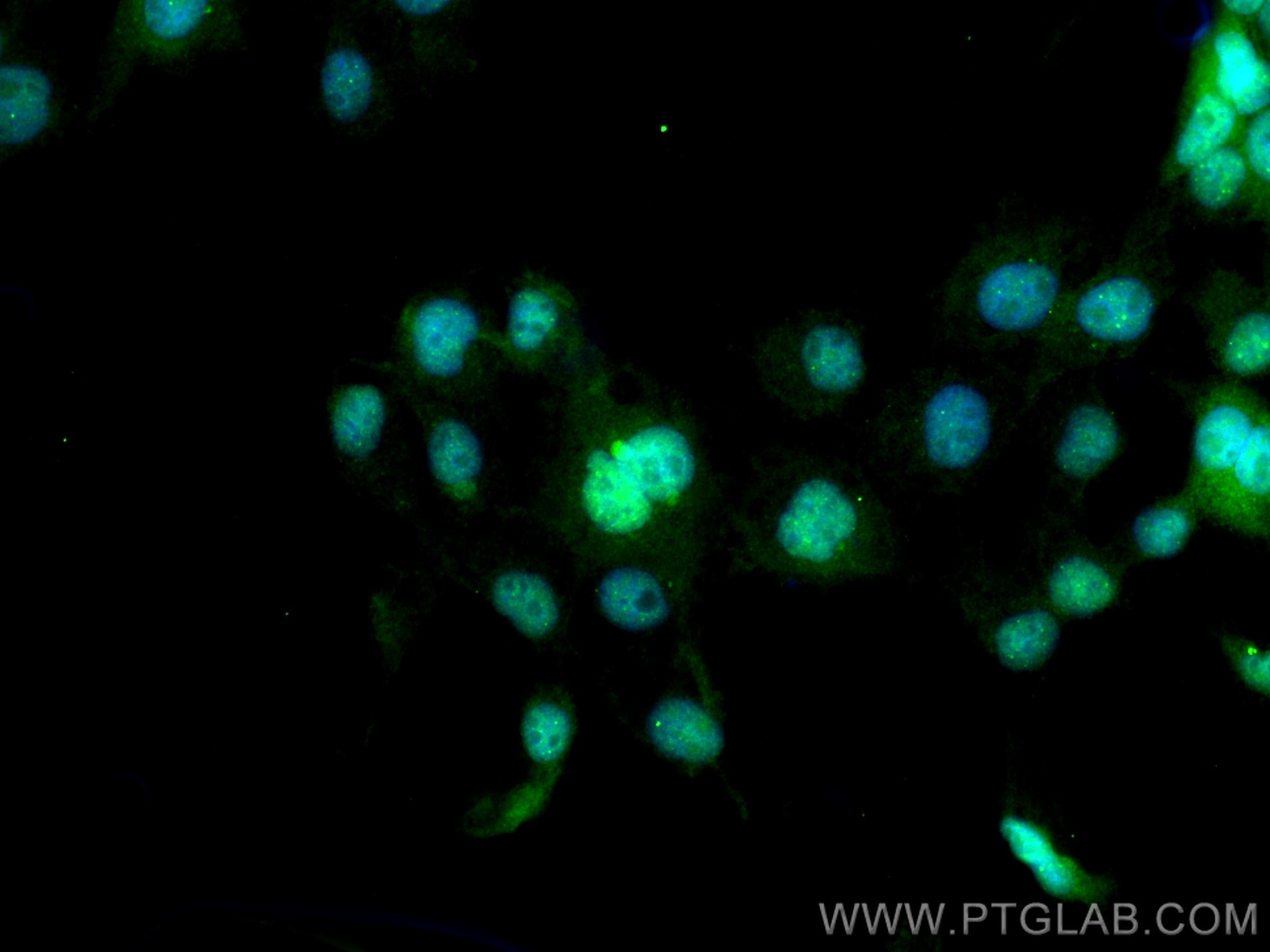 Immunofluorescence (IF) / fluorescent staining of A431 cells using SETDB1 Polyclonal antibody (11231-1-AP)