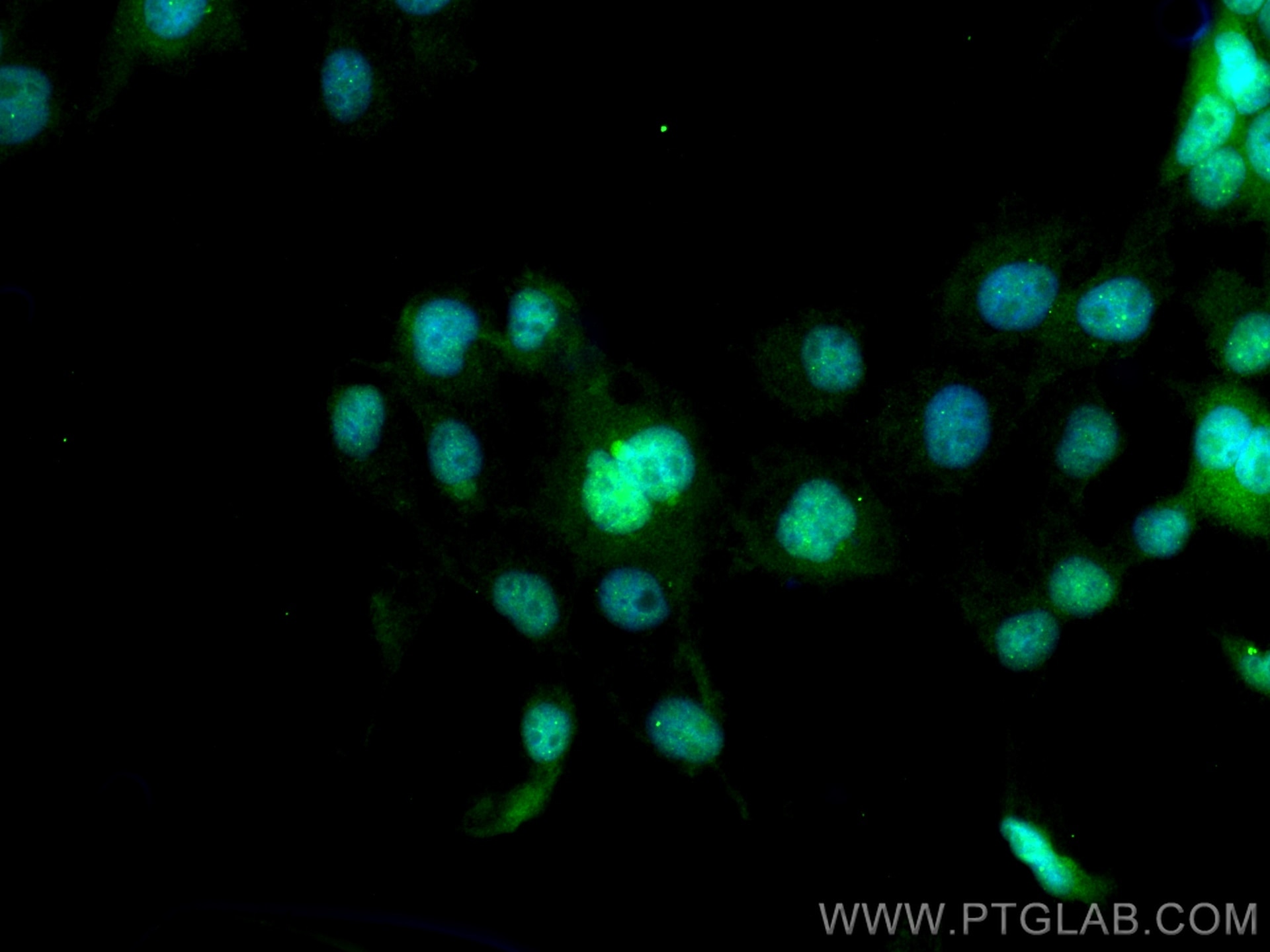 IF Staining of A431 using 11231-1-AP