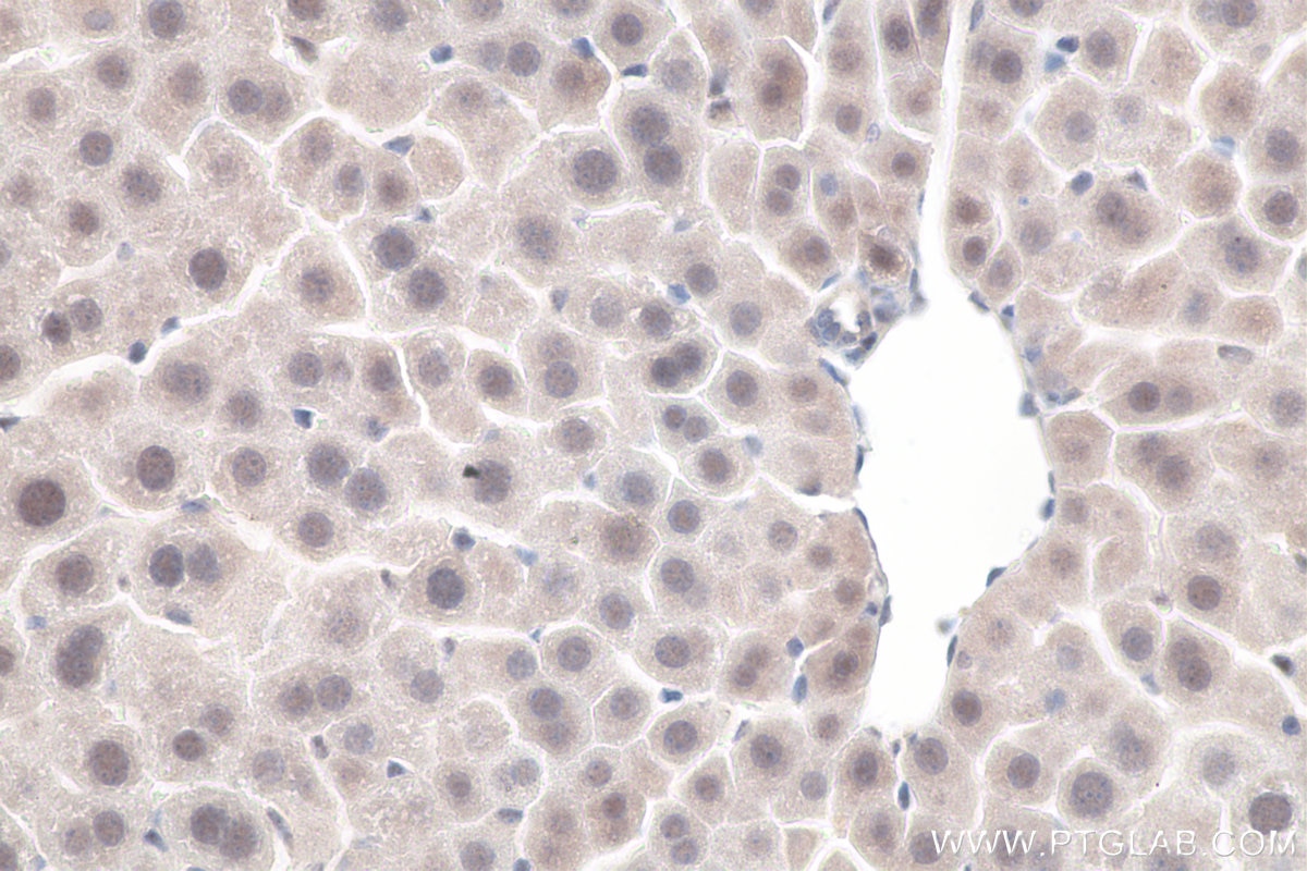 IHC staining of mouse liver using 11231-1-AP Immunohistochemistry (IHC) staining of mouse liver tissue using SETDB1 Polyclonal antibody (11231-1-AP)