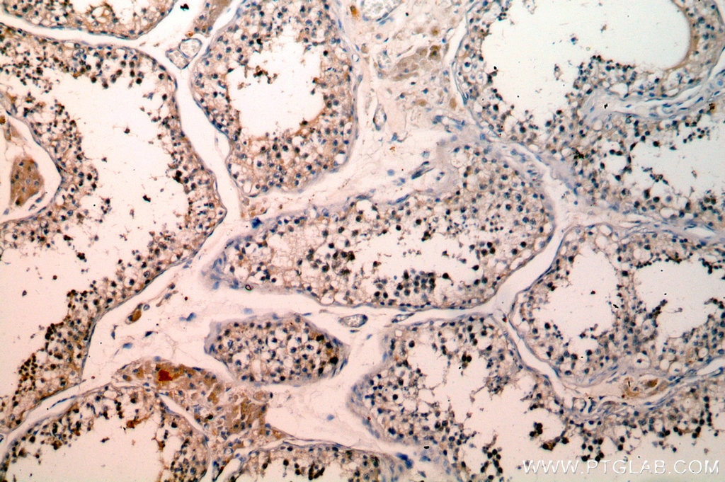 Immunohistochemistry (IHC) staining of human testis tissue using SETDB1 Polyclonal antibody (11231-1-AP)