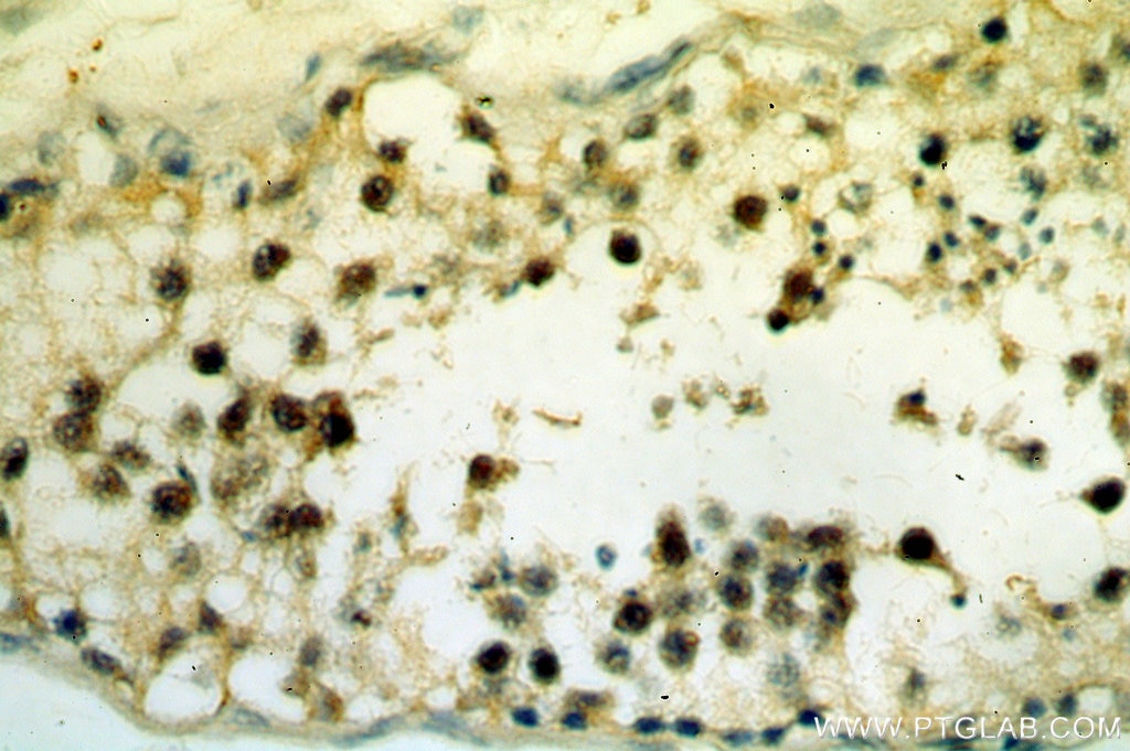 Immunohistochemistry (IHC) staining of human testis tissue using SETDB1 Polyclonal antibody (11231-1-AP)