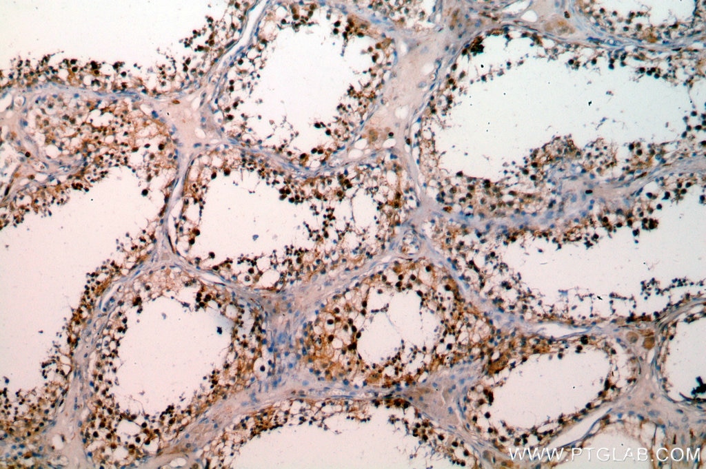 IHC staining of human testis using 11231-1-AP