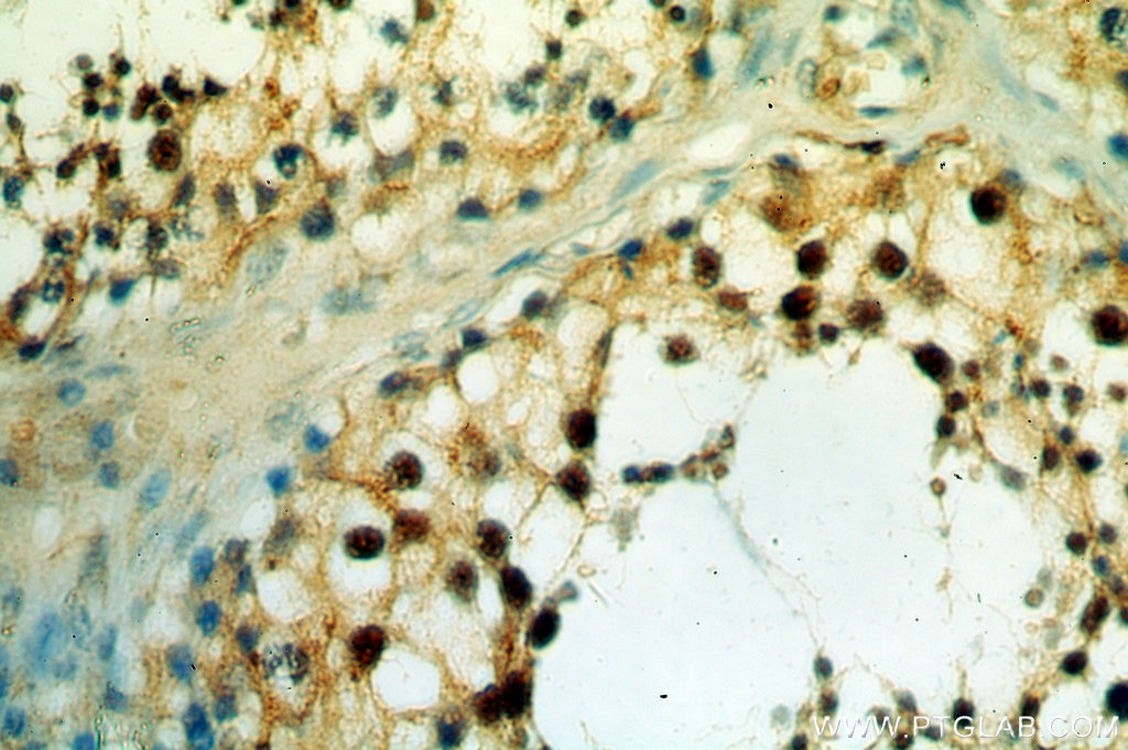 IHC staining of human testis using 11231-1-AP