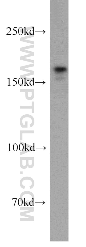 Western Blot (WB) analysis of PC-3 cells using SETDB1 Polyclonal antibody (11231-1-AP)