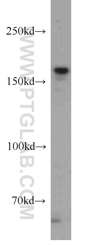 WB analysis of PC-3 using 11231-1-AP