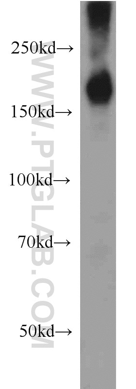 WB analysis of human testis using 11231-1-AP