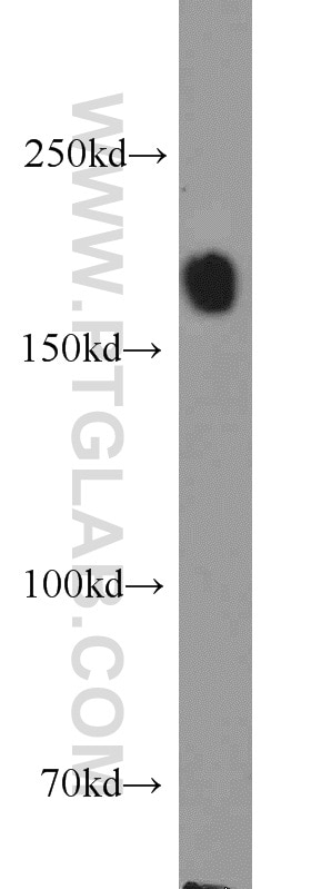 Western Blot (WB) analysis of Jurkat cells using SETDB1 Polyclonal antibody (11231-1-AP)