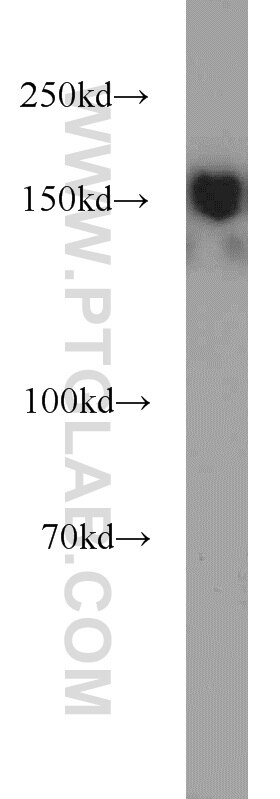 WB analysis of MCF-7 using 11231-1-AP