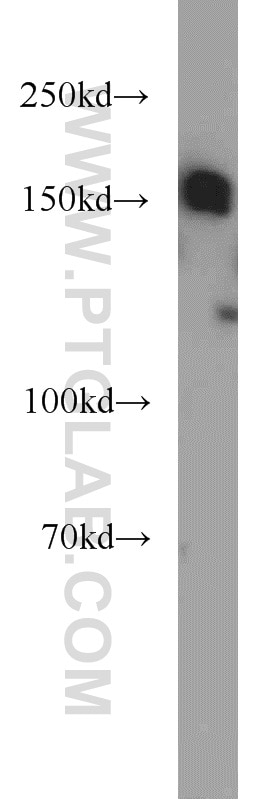 Western Blot (WB) analysis of MCF-7 cells using SETDB1 Polyclonal antibody (11231-1-AP)