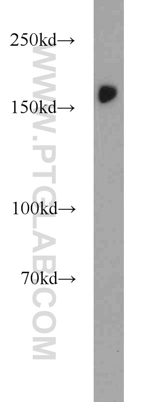 Western Blot (WB) analysis of HEK-293 cells using SETDB1 Polyclonal antibody (11231-1-AP)