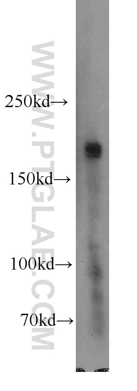 Western Blot (WB) analysis of Jurkat cells using SETDB1 Polyclonal antibody (11231-1-AP)