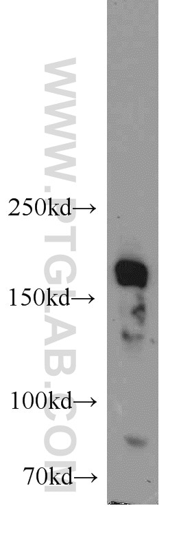 Western Blot (WB) analysis of human testis tissue using SETDB1 Polyclonal antibody (11231-1-AP)