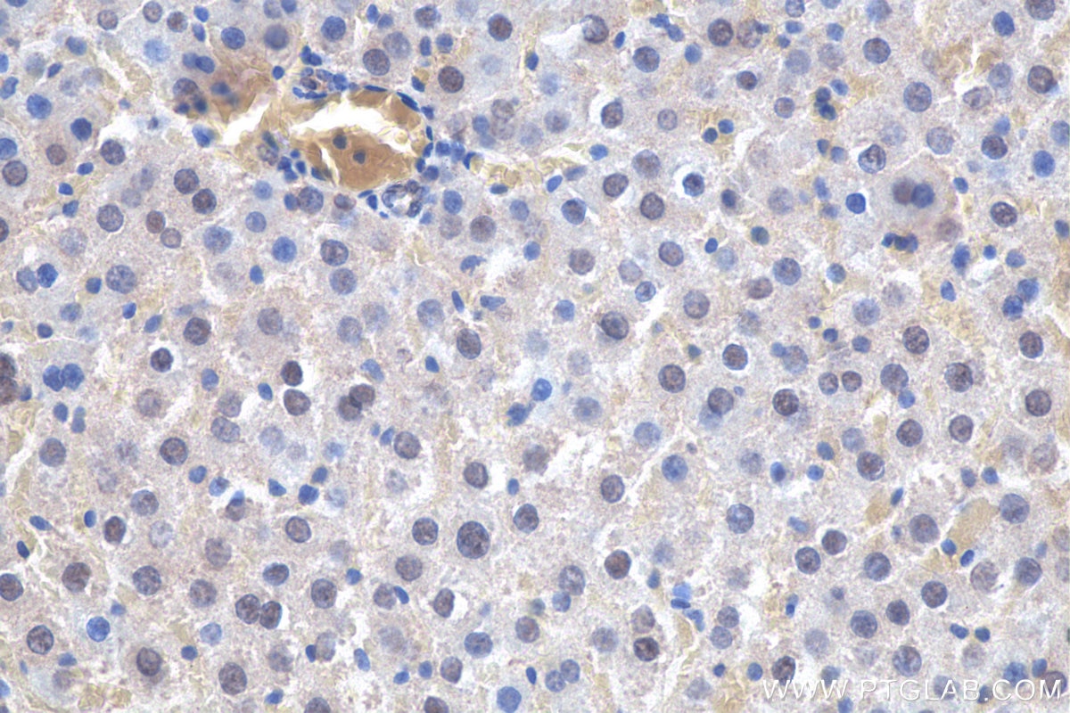 IHC staining of rat liver using 66293-1-Ig
