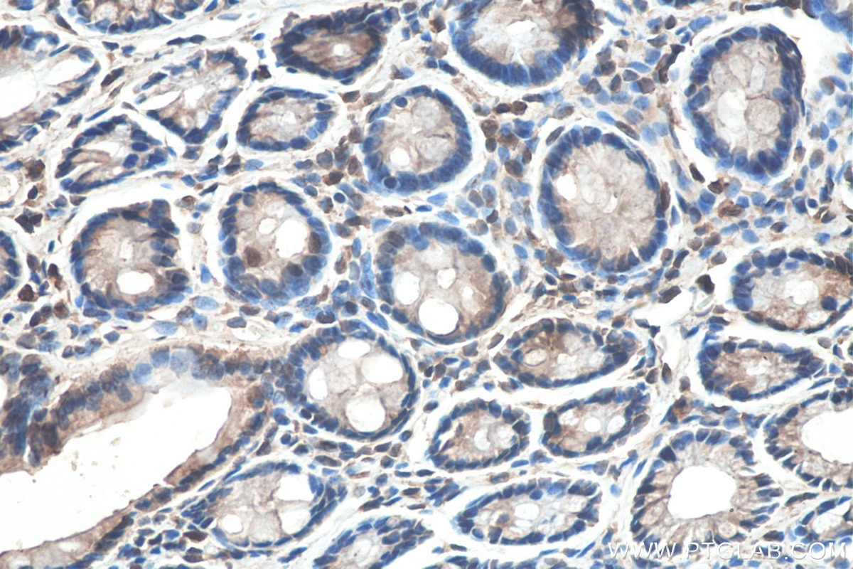 Immunohistochemistry (IHC) staining of rat colon tissue using SETDB1 Monoclonal antibody (66293-1-Ig)