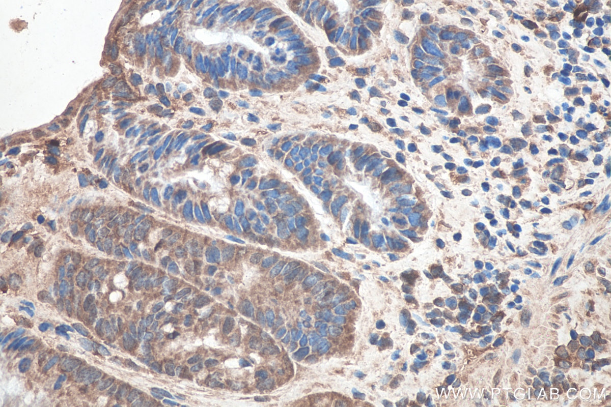 Immunohistochemistry (IHC) staining of mouse colon tissue using SETDB1 Monoclonal antibody (66293-1-Ig)