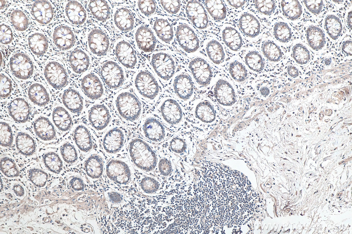 Immunohistochemistry (IHC) staining of human colon tissue using SETDB1 Monoclonal antibody (66293-1-Ig)
