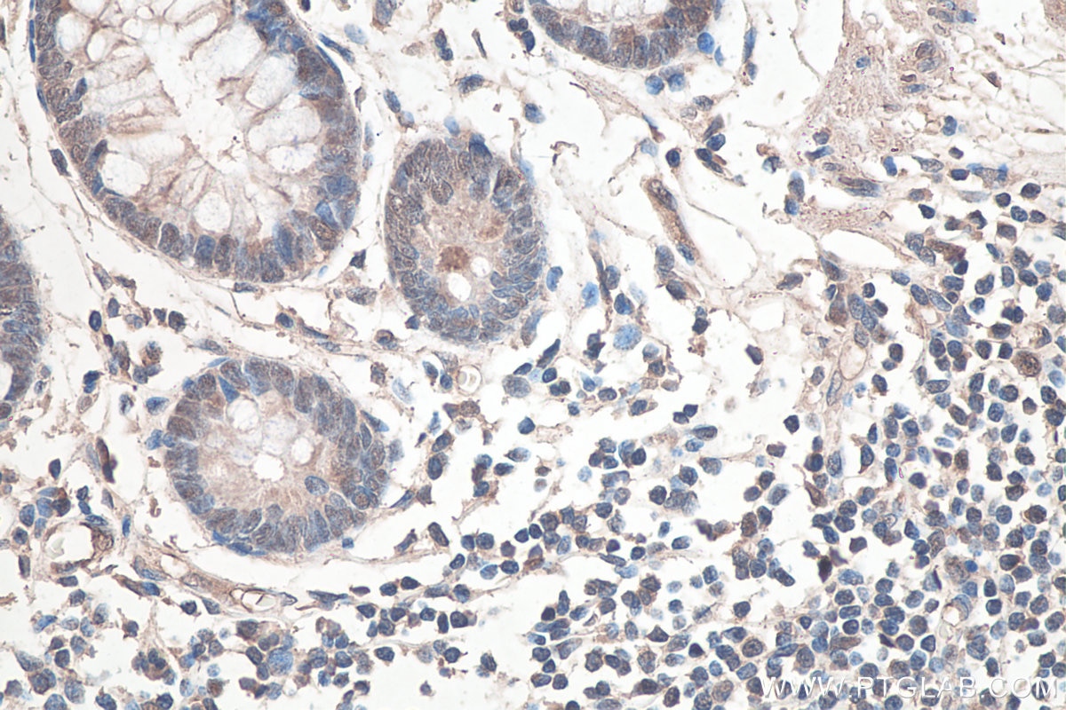 Immunohistochemistry (IHC) staining of human colon tissue using SETDB1 Monoclonal antibody (66293-1-Ig)