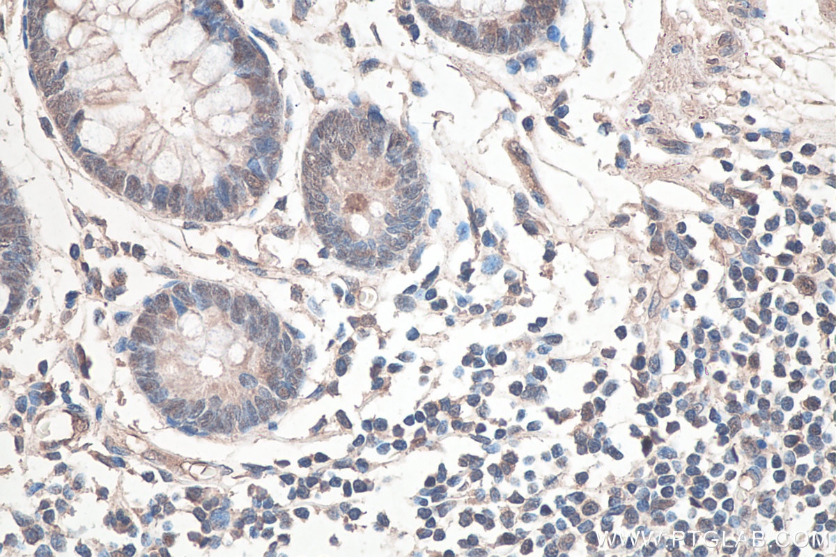 IHC staining of human colon using 66293-1-Ig